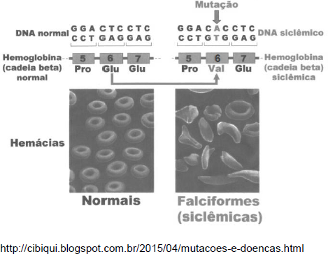 AIO | A Anemia Falciforme E Uma Doenca Genetica E